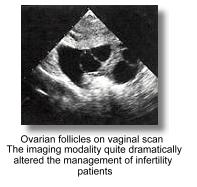 Gynecological Ultrasound